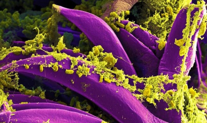 New Mexico Confirms First Human Plague Case of 2025 in Valencia County Camper