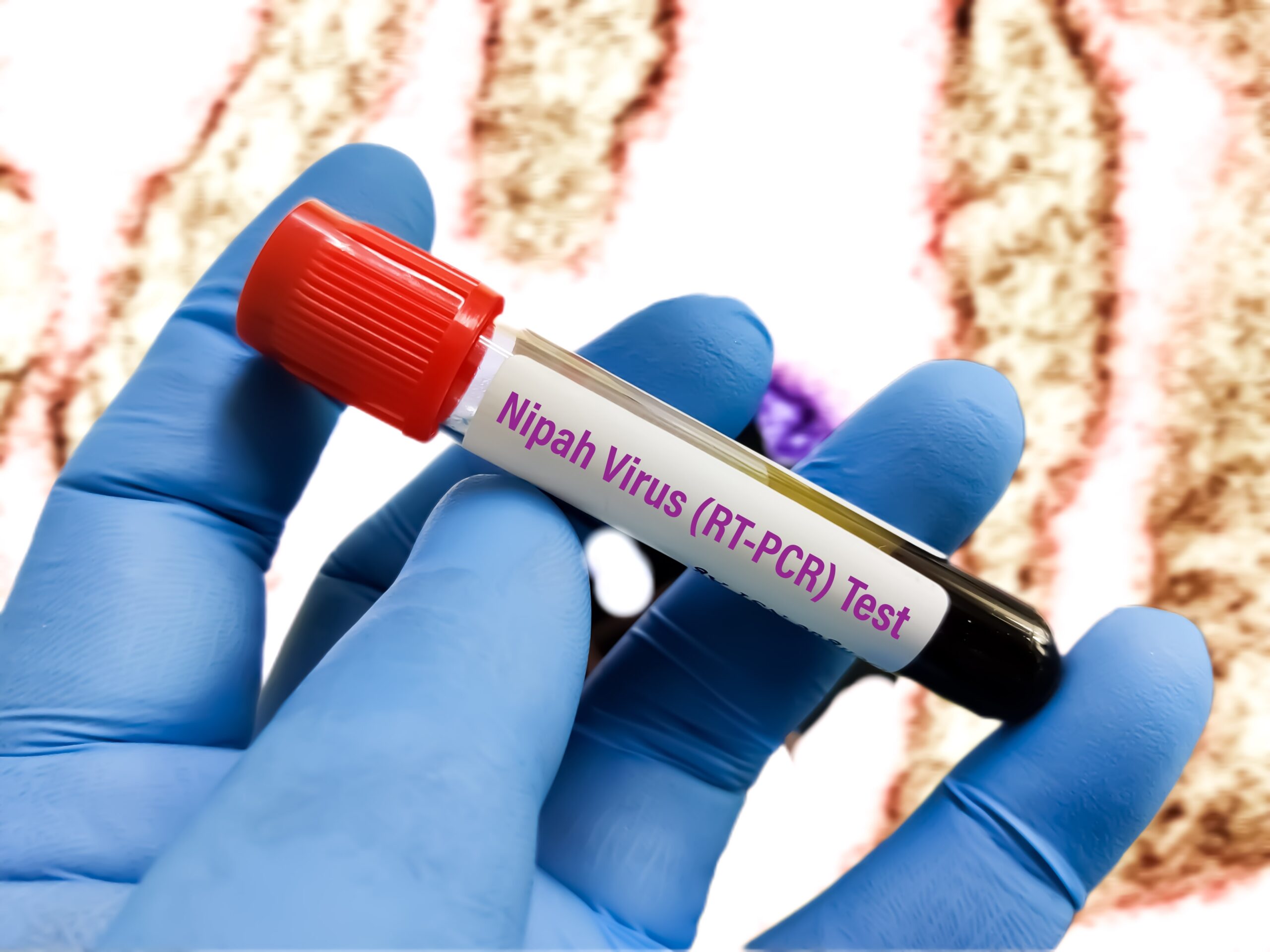 Asia Scrambles as Nipah Outbreak Forces Mass Quarantines and Triggers Global Health Alert