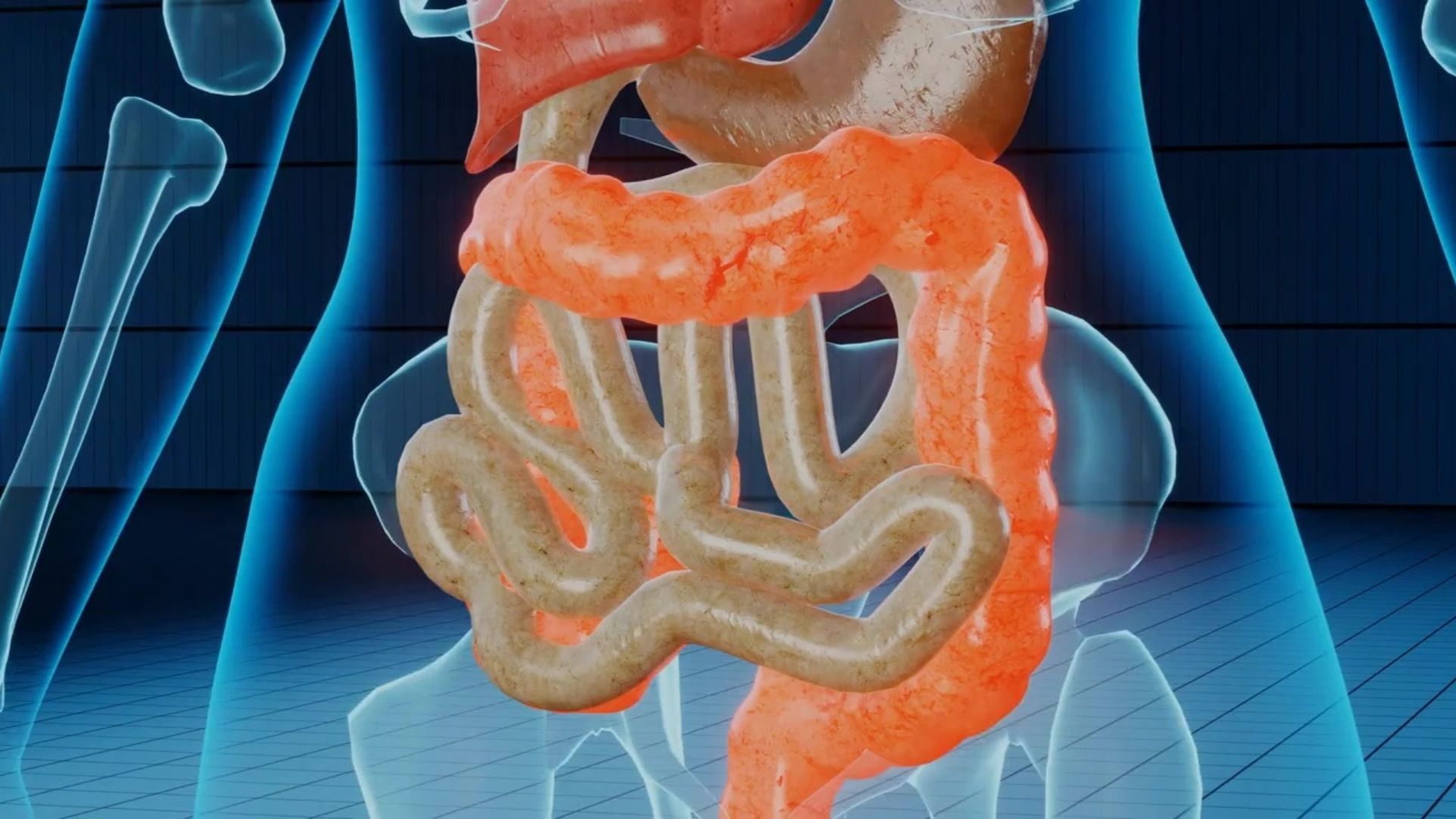 March is National Colorectal Cancer Awareness Month