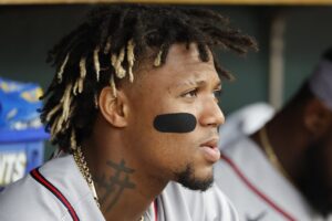 Braves' Ronald Acuna Jr. (hand) day-to-day after HBP