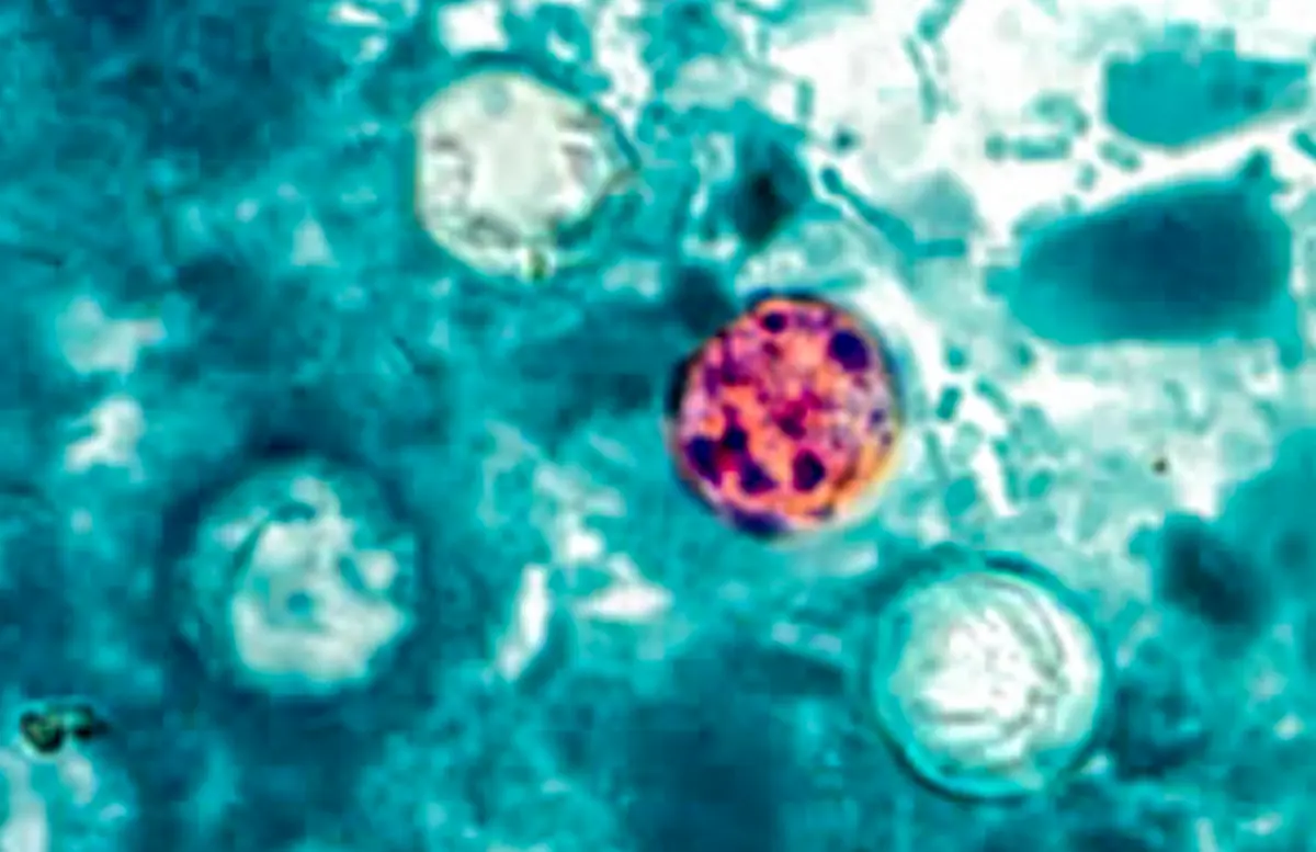 FDA Unveils 10-Point Plan After Nearly 20,000 Cyclospora Cases Reported Across U.S.